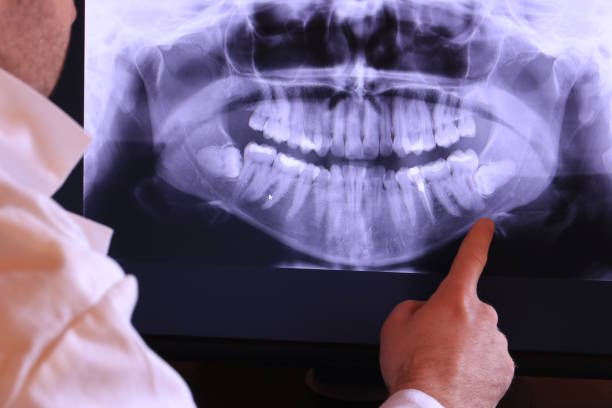 Best Emergency Gum Treatment in Lincoln, NE