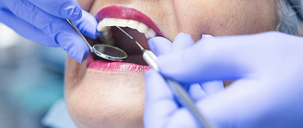 Best Emergency Treatment for Dental Infections or Abscesses in Lincoln, NE